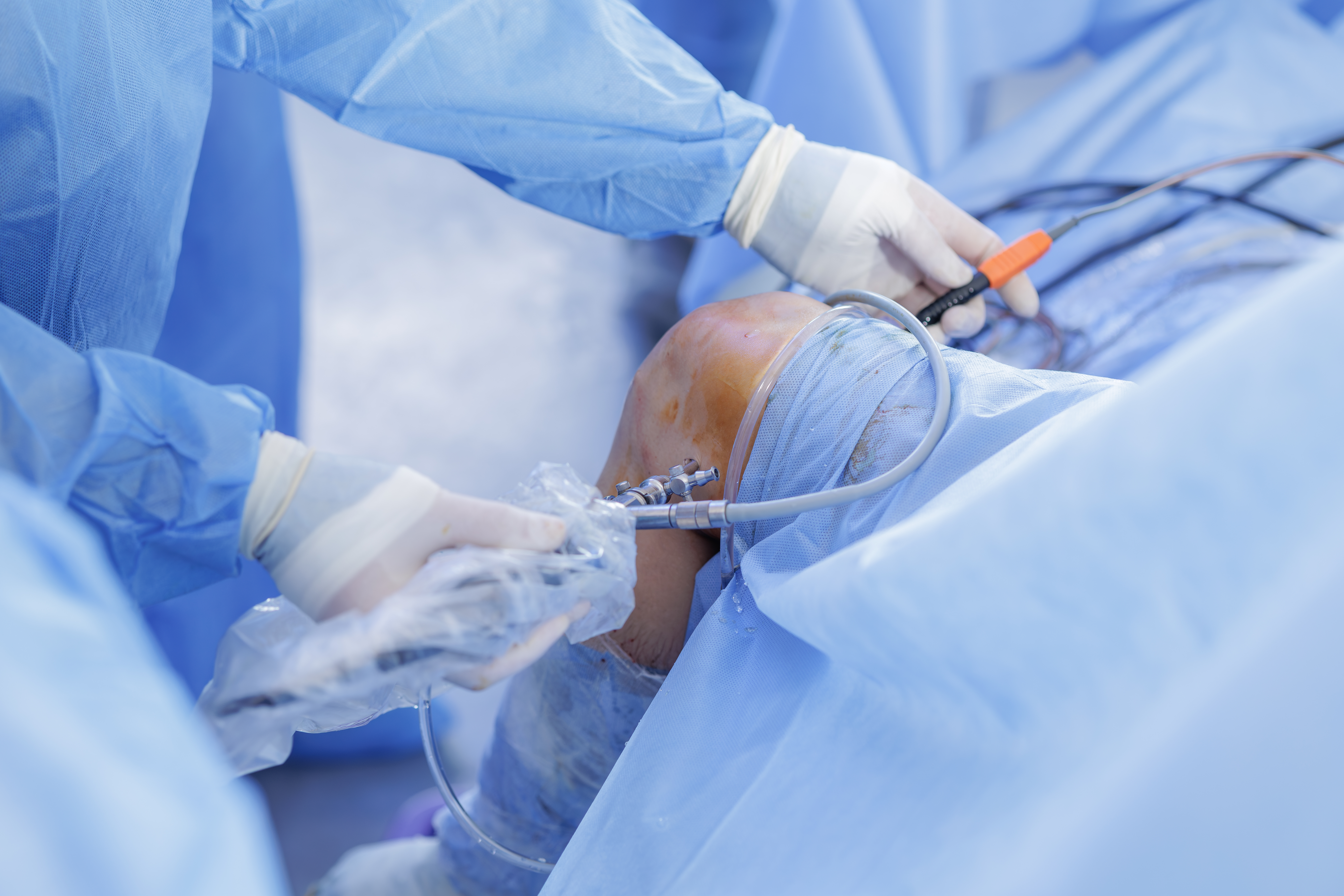 ԱՐԹՐՈՍԿՈՊԻԱ